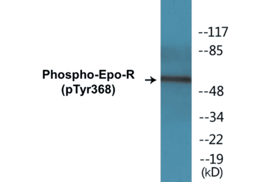 Western Blot - Epo-R (phospho Tyr368) Cell Based ELISA Kit (CBP1368) - Antibodies.com