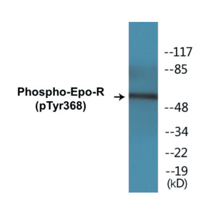 Western Blot - Epo-R (phospho Tyr368) Cell Based ELISA Kit (CBP1368) - Antibodies.com