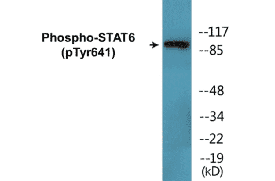 Western Blot - STAT6 (phospho Tyr641) Cell Based ELISA Kit (CBP1686) - Antibodies.com