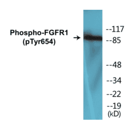 Western Blot - FGFR1 (phospho Tyr654) Cell Based ELISA Kit (CBP1156) - Antibodies.com