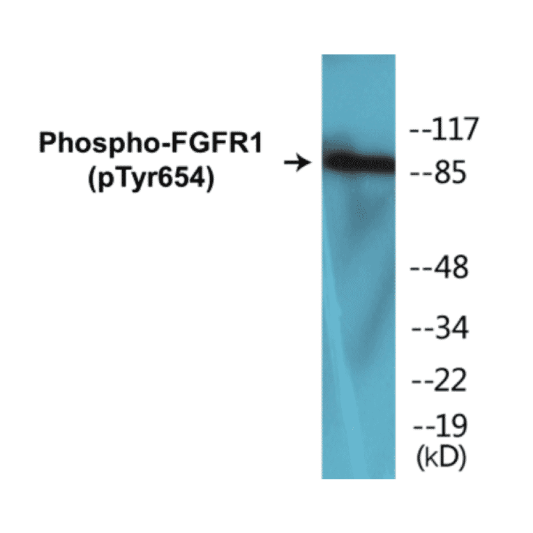 Western Blot - FGFR1 (phospho Tyr654) Cell Based ELISA Kit (CBP1156) - Antibodies.com