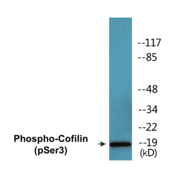Western Blot - Cofilin (phospho Ser3) Cell Based ELISA Kit (CBP1521) - Antibodies.com