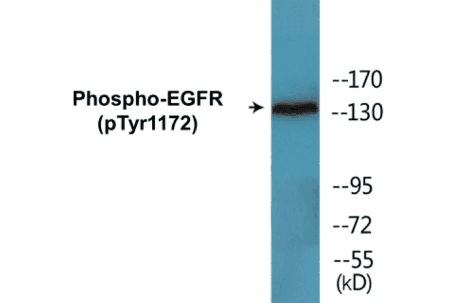 Western Blot - EGFR (phospho Tyr1172) Cell Based ELISA Kit (CBP1535) - Antibodies.com