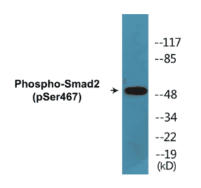 Western Blot - Smad2 (phospho Ser467) Cell Based ELISA Kit (CBP1029) - Antibodies.com