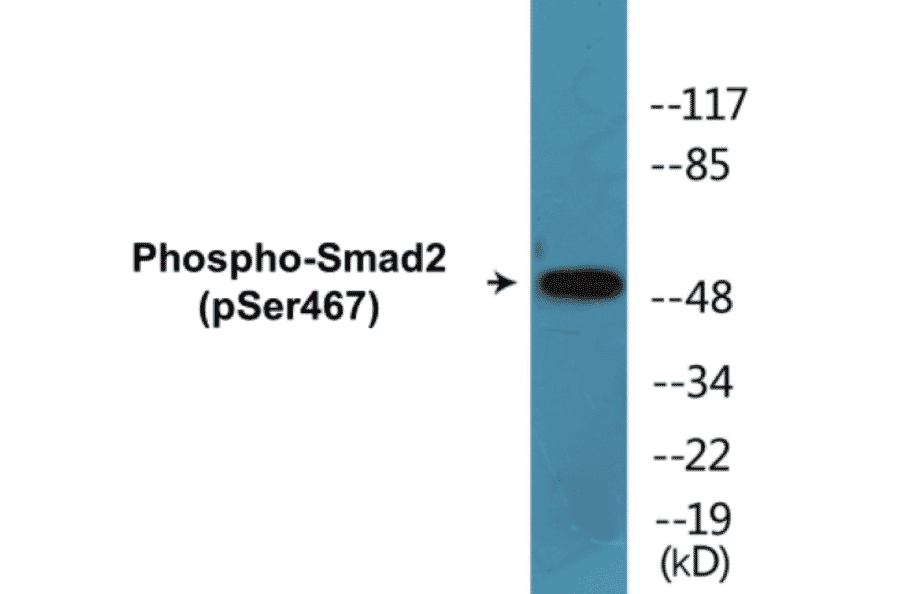 Western Blot - Smad2 (phospho Ser467) Cell Based ELISA Kit (CBP1029) - Antibodies.com