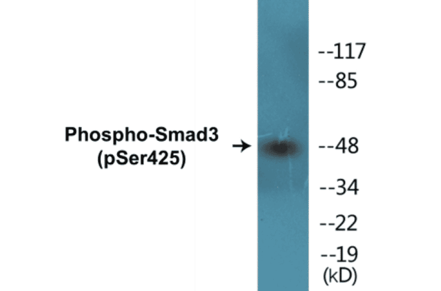 Western Blot - Smad3 (phospho Ser425) Cell Based ELISA Kit (CBP1030) - Antibodies.com