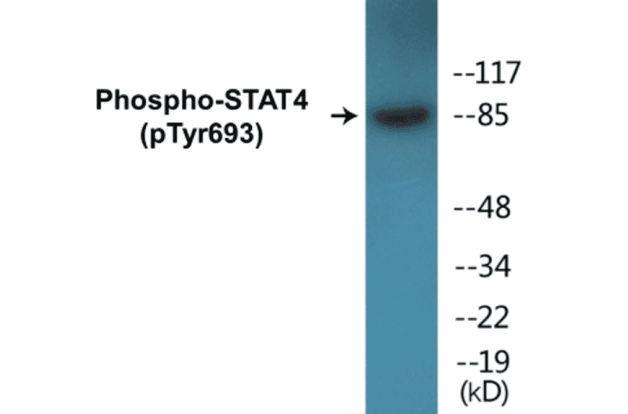 Western Blot - STAT4 (phospho Tyr693) Cell Based ELISA Kit (CBP1044) - Antibodies.com