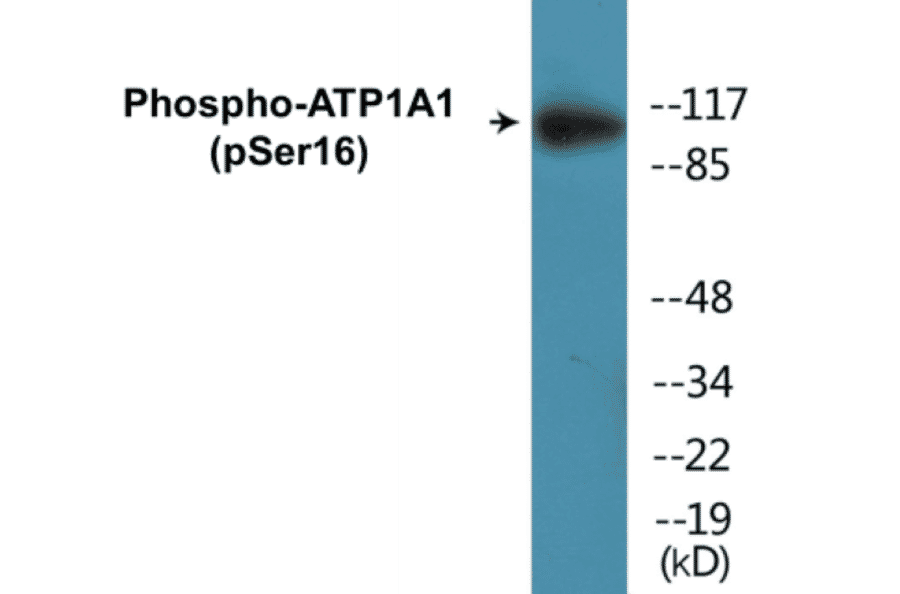 Western Blot - ATP1A1 (phospho Ser16) Cell Based ELISA Kit (CBP1140) - Antibodies.com