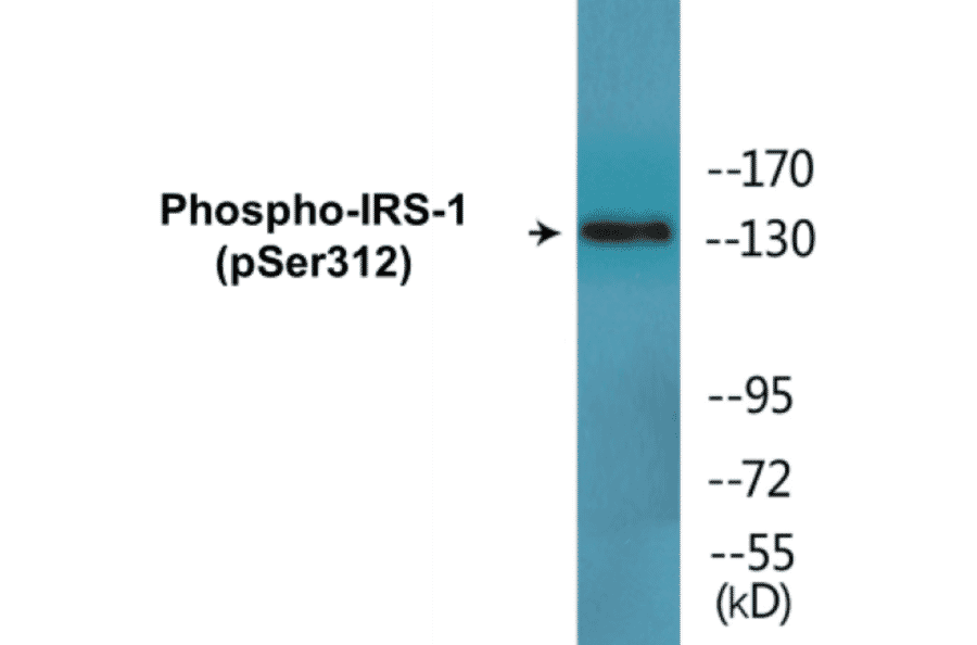 Western Blot - IRS-1 (phospho Ser312) Cell Based ELISA Kit (CBP1589) - Antibodies.com