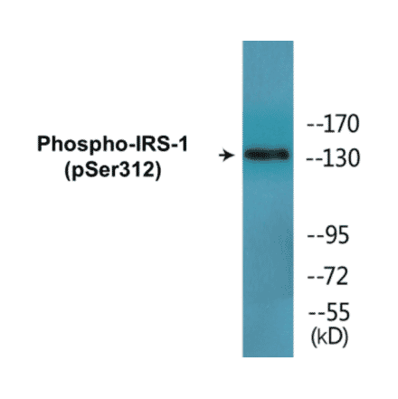 Western Blot - IRS-1 (phospho Ser312) Cell Based ELISA Kit (CBP1589) - Antibodies.com