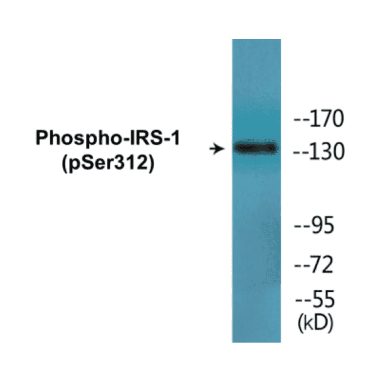 Western Blot - IRS-1 (phospho Ser312) Cell Based ELISA Kit (CBP1589) - Antibodies.com