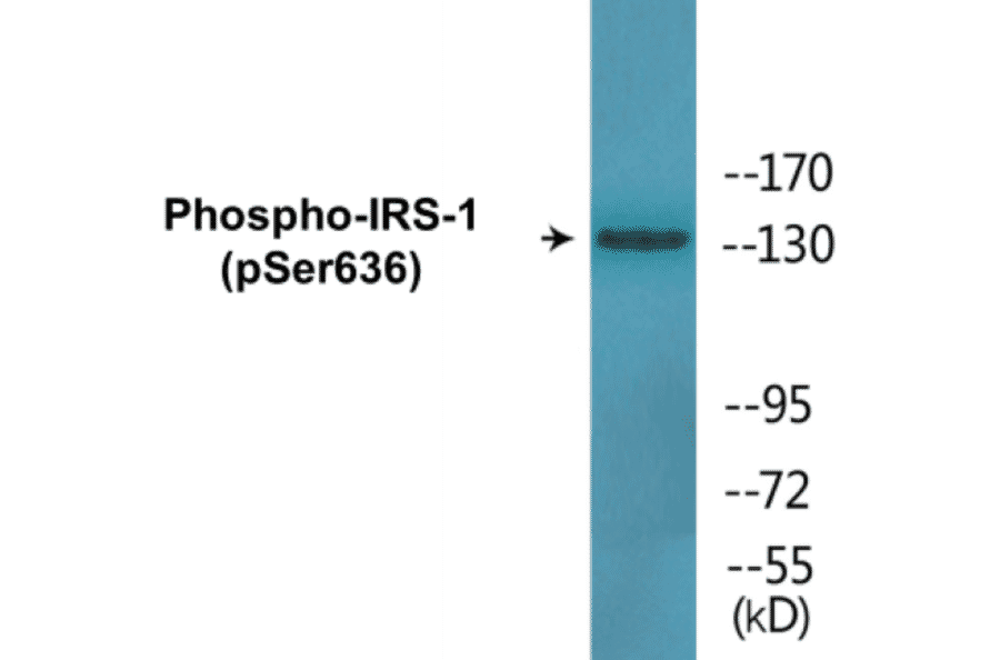 Western Blot - IRS-1 (phospho Ser636) Cell Based ELISA Kit (CBP1590) - Antibodies.com