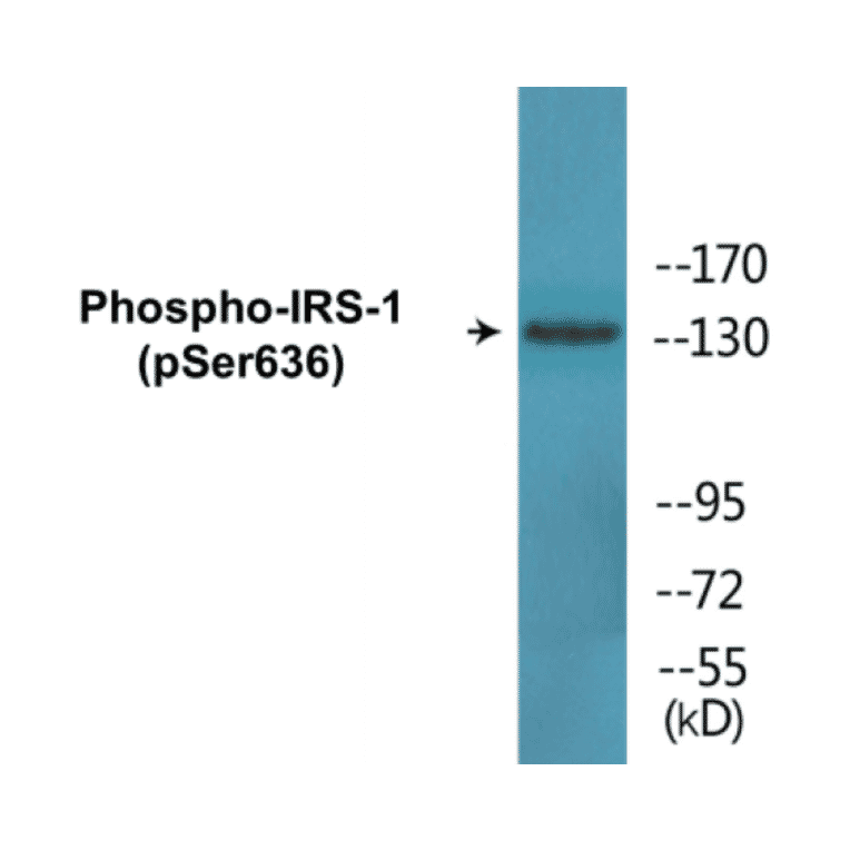Western Blot - IRS-1 (phospho Ser636) Cell Based ELISA Kit (CBP1590) - Antibodies.com