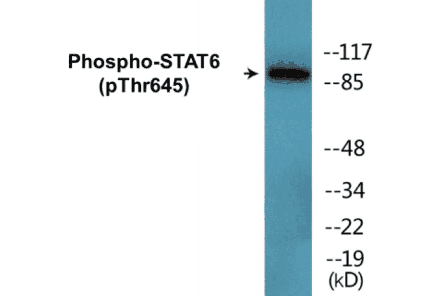 Western Blot - STAT6 (phospho Thr645) Cell Based ELISA Kit (CBP1685) - Antibodies.com