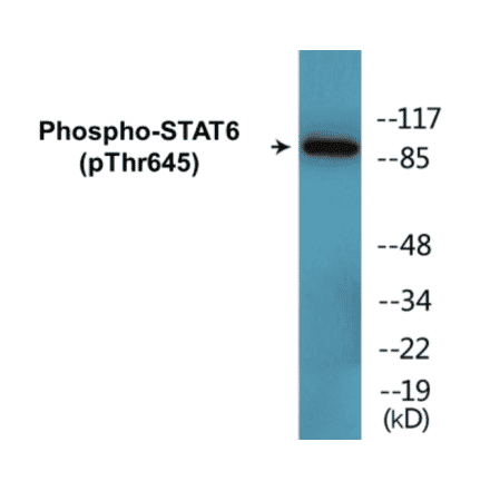 Western Blot - STAT6 (phospho Thr645) Cell Based ELISA Kit (CBP1685) - Antibodies.com