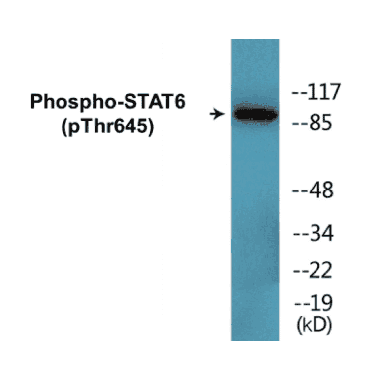 Western Blot - STAT6 (phospho Thr645) Cell Based ELISA Kit (CBP1685) - Antibodies.com