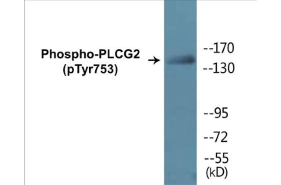 Western Blot - PLCG2 (phospho Tyr753) Cell Based ELISA Kit (CBP1074) - Antibodies.com