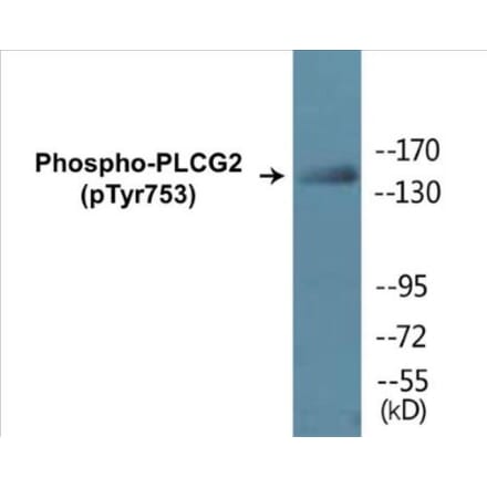 Western Blot - PLCG2 (phospho Tyr753) Cell Based ELISA Kit (CBP1074) - Antibodies.com