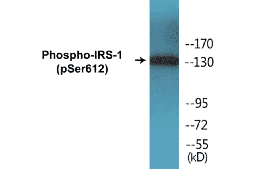 Western Blot - IRS-1 (phospho Ser612) Cell Based ELISA Kit (CBP1133) - Antibodies.com