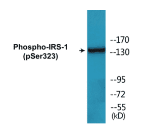 Western Blot - IRS-1 (phospho Ser323) Cell Based ELISA Kit (CBP1167) - Antibodies.com