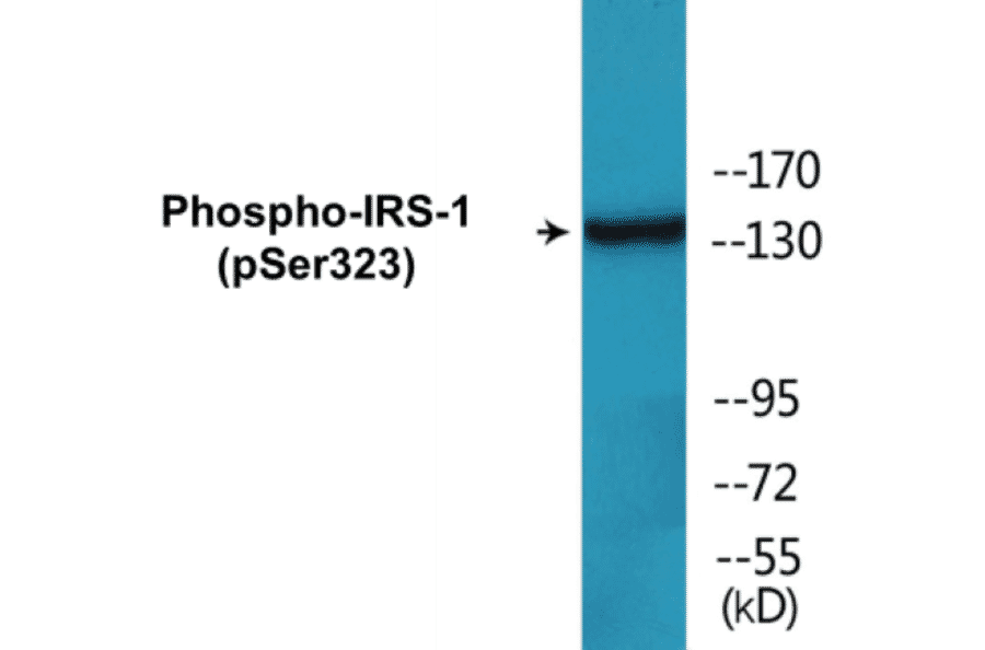 Western Blot - IRS-1 (phospho Ser323) Cell Based ELISA Kit (CBP1167) - Antibodies.com