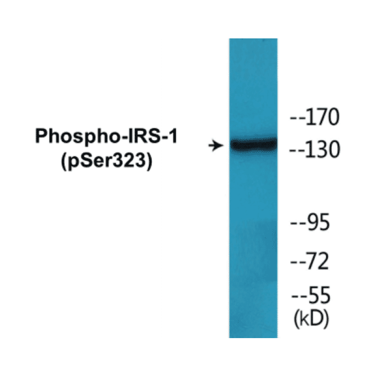 Western Blot - IRS-1 (phospho Ser323) Cell Based ELISA Kit (CBP1167) - Antibodies.com
