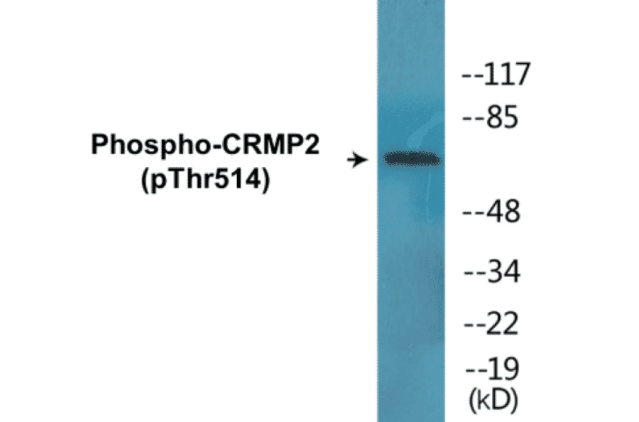 Western Blot - CRMP2 (phospho Thr514) Cell Based ELISA Kit (CBP1467) - Antibodies.com