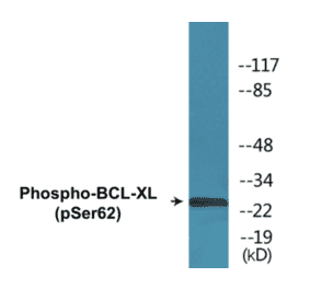 Western Blot - BCL-XL (phospho Ser62) Cell Based ELISA Kit (CBP1507) - Antibodies.com