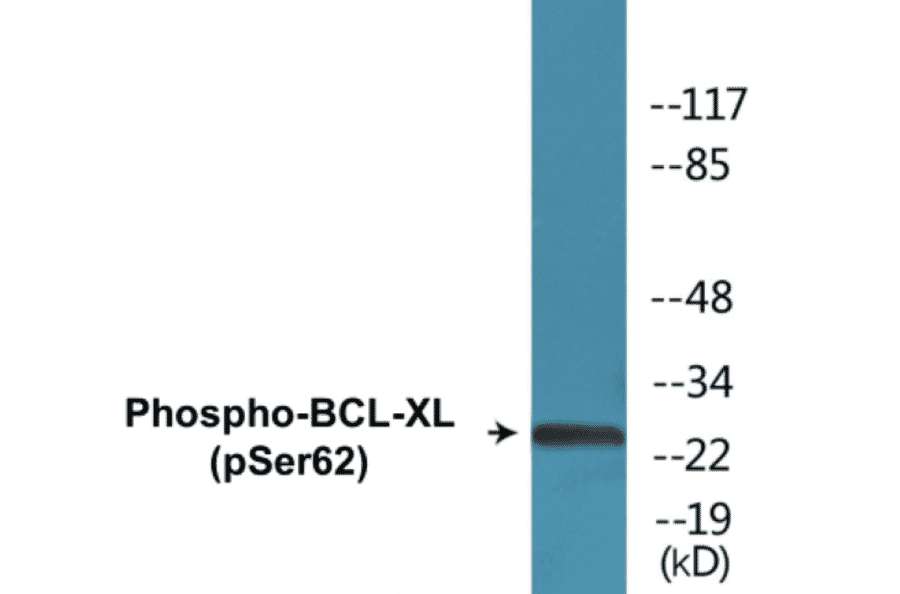 Western Blot - BCL-XL (phospho Ser62) Cell Based ELISA Kit (CBP1507) - Antibodies.com