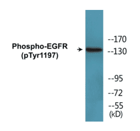 Western Blot - EGFR (phospho Tyr1197) Cell Based ELISA Kit (CBP1536) - Antibodies.com