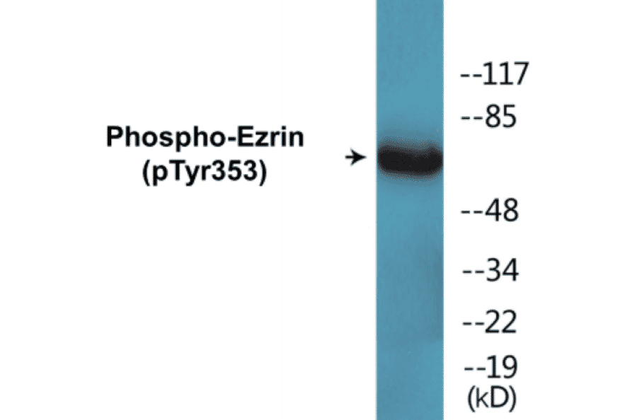 Western Blot - Ezrin (phospho Tyr353) Cell Based ELISA Kit (CBP1551) - Antibodies.com