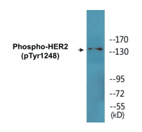 Western Blot - HER2 (phospho Tyr1248) Cell Based ELISA Kit (CBP1573) - Antibodies.com