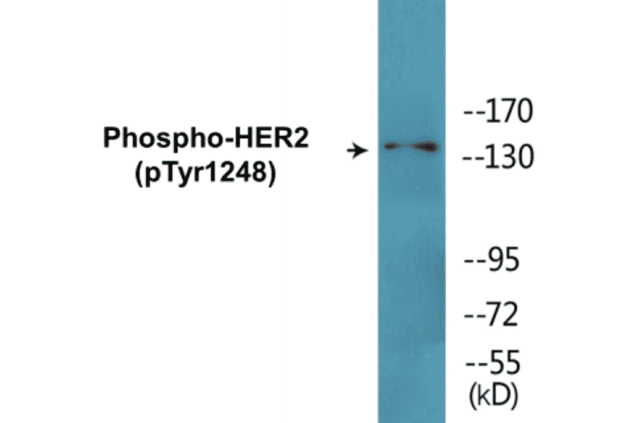 Western Blot - HER2 (phospho Tyr1248) Cell Based ELISA Kit (CBP1573) - Antibodies.com