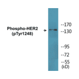 Western Blot - HER2 (phospho Tyr1248) Cell Based ELISA Kit (CBP1573) - Antibodies.com