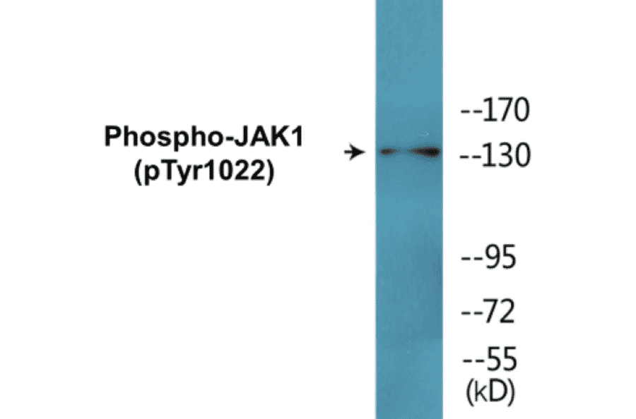 Western Blot - JAK1 (phospho Tyr1022) Cell Based ELISA Kit (CBP1592) - Antibodies.com