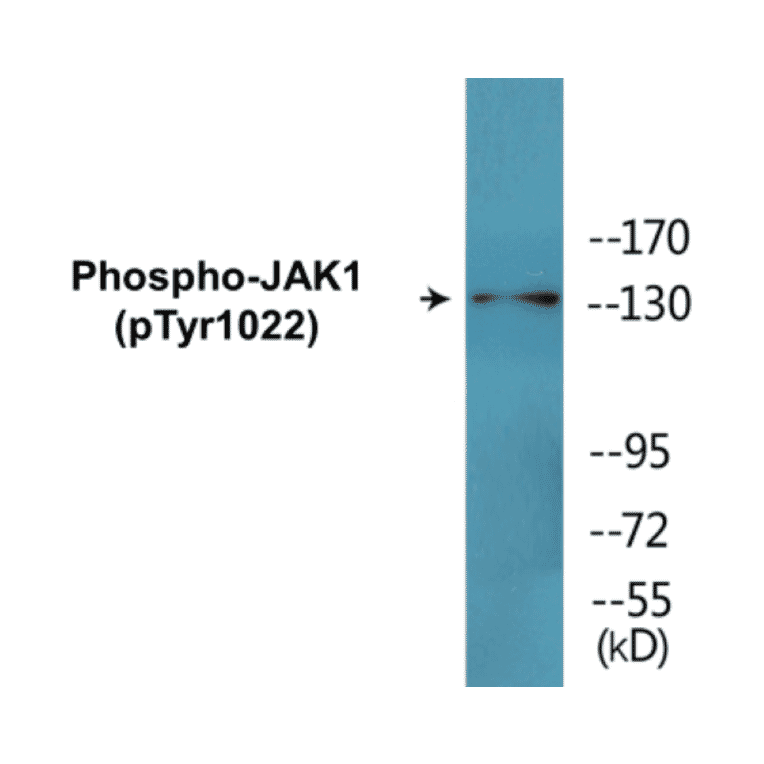 Western Blot - JAK1 (phospho Tyr1022) Cell Based ELISA Kit (CBP1592) - Antibodies.com