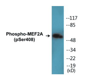 Western Blot - MEF2A (phospho Ser408) Cell Based ELISA Kit (CBP1019) - Antibodies.com