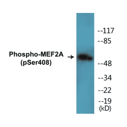 Western Blot - MEF2A (phospho Ser408) Cell Based ELISA Kit (CBP1019) - Antibodies.com