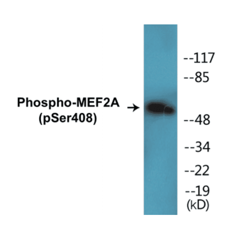 Western Blot - MEF2A (phospho Ser408) Cell Based ELISA Kit (CBP1019) - Antibodies.com