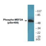 Western Blot - MEF2A (phospho Ser408) Cell Based ELISA Kit (CBP1019) - Antibodies.com