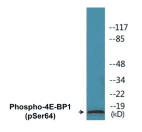 Western Blot - 4E-BP1 (phospho Ser64) Cell Based ELISA Kit (CBP1093) - Antibodies.com