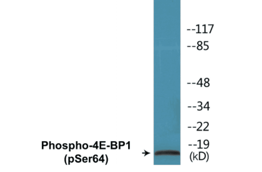 Western Blot - 4E-BP1 (phospho Ser64) Cell Based ELISA Kit (CBP1093) - Antibodies.com