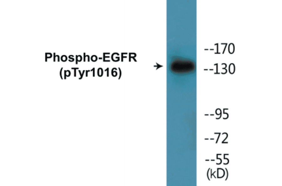 Western Blot - EGFR (phospho Tyr1016) Cell Based ELISA Kit (CBP1151) - Antibodies.com