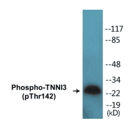 Western Blot - TNNI3 (phospho Thr142) Cell Based ELISA Kit (CBP1226) - Antibodies.com