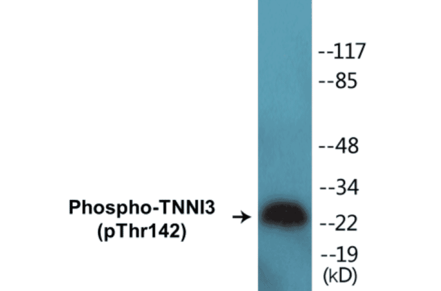Western Blot - TNNI3 (phospho Thr142) Cell Based ELISA Kit (CBP1226) - Antibodies.com