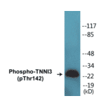 Western Blot - TNNI3 (phospho Thr142) Cell Based ELISA Kit (CBP1226) - Antibodies.com