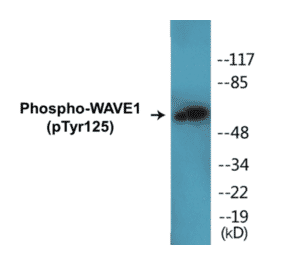 Western Blot - WAVE1 (phospho Tyr125) Cell Based ELISA Kit (CBP1232) - Antibodies.com