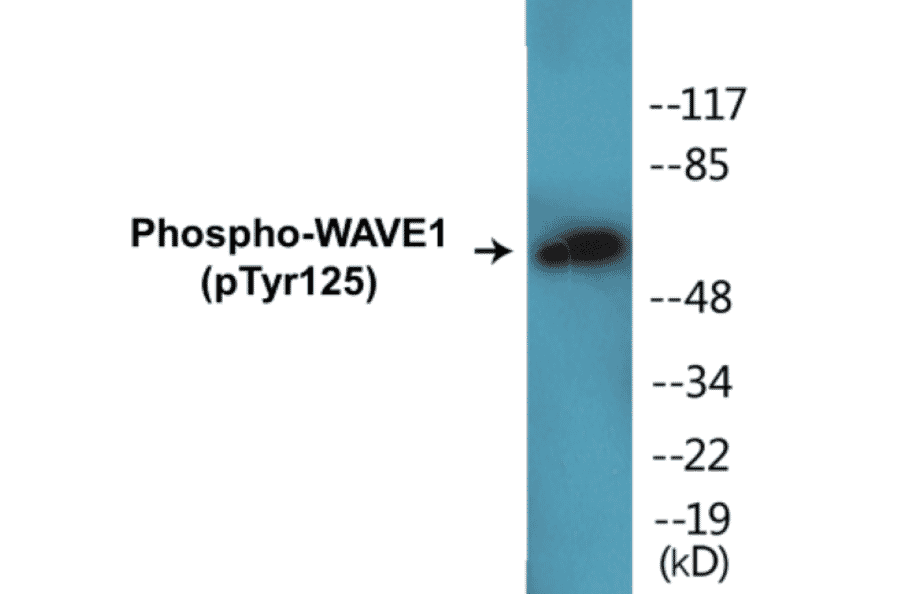 Western Blot - WAVE1 (phospho Tyr125) Cell Based ELISA Kit (CBP1232) - Antibodies.com