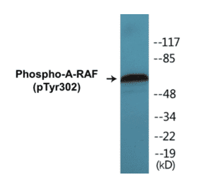 Western Blot - A-RAF (phospho Tyr302) Cell Based ELISA Kit (CBP1292) - Antibodies.com