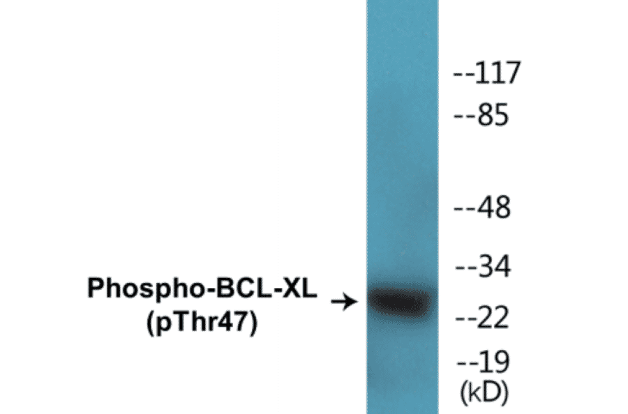 Western Blot - BCL-XL (phospho Thr47) Cell Based ELISA Kit (CBP1295) - Antibodies.com